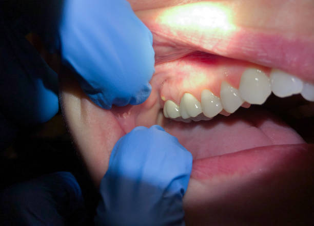 Best Emergency Dental Care for Trauma or Injury in Dale, PA